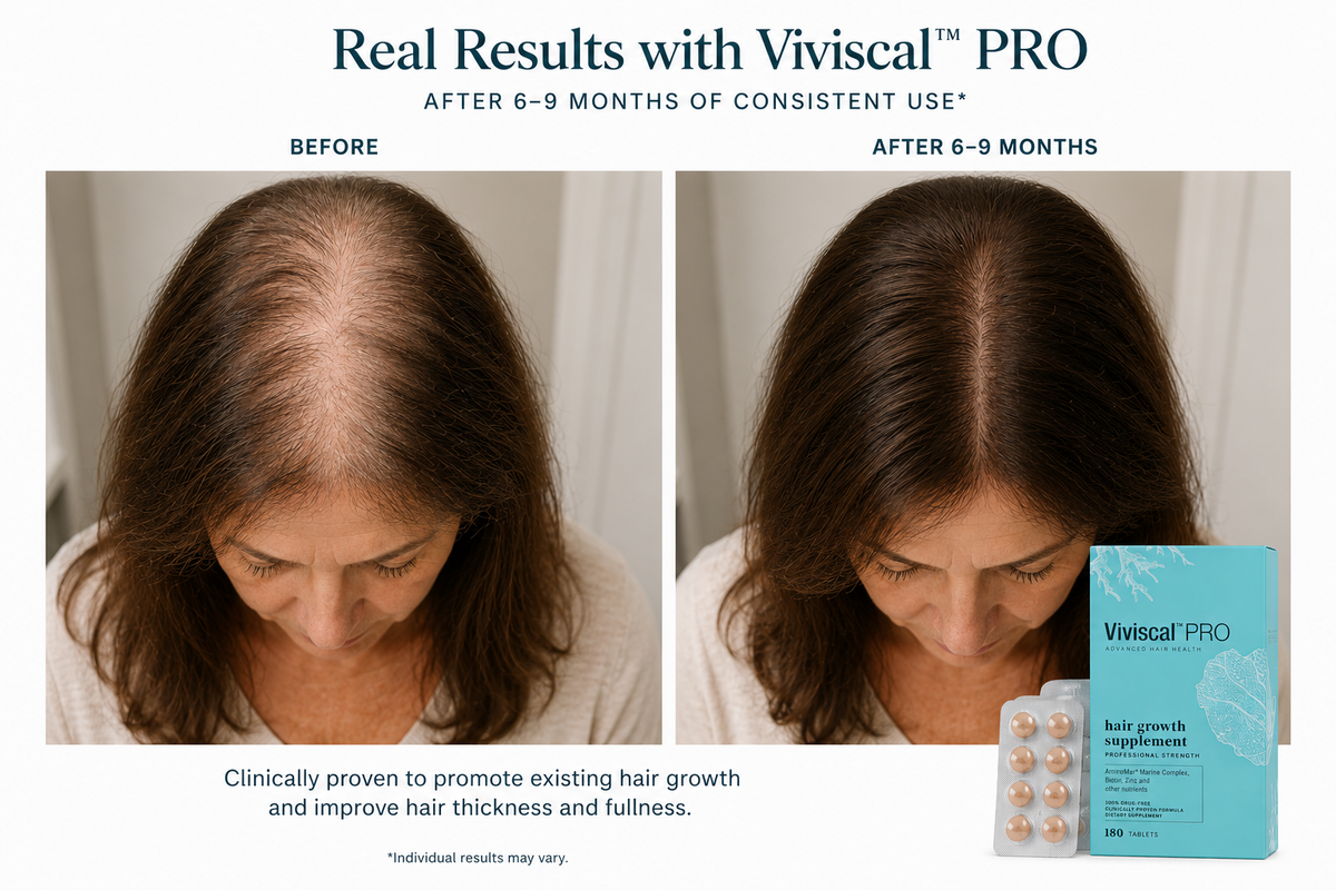 Viviscal Professional Supplements – 180 Tablets (90-Day Supply)