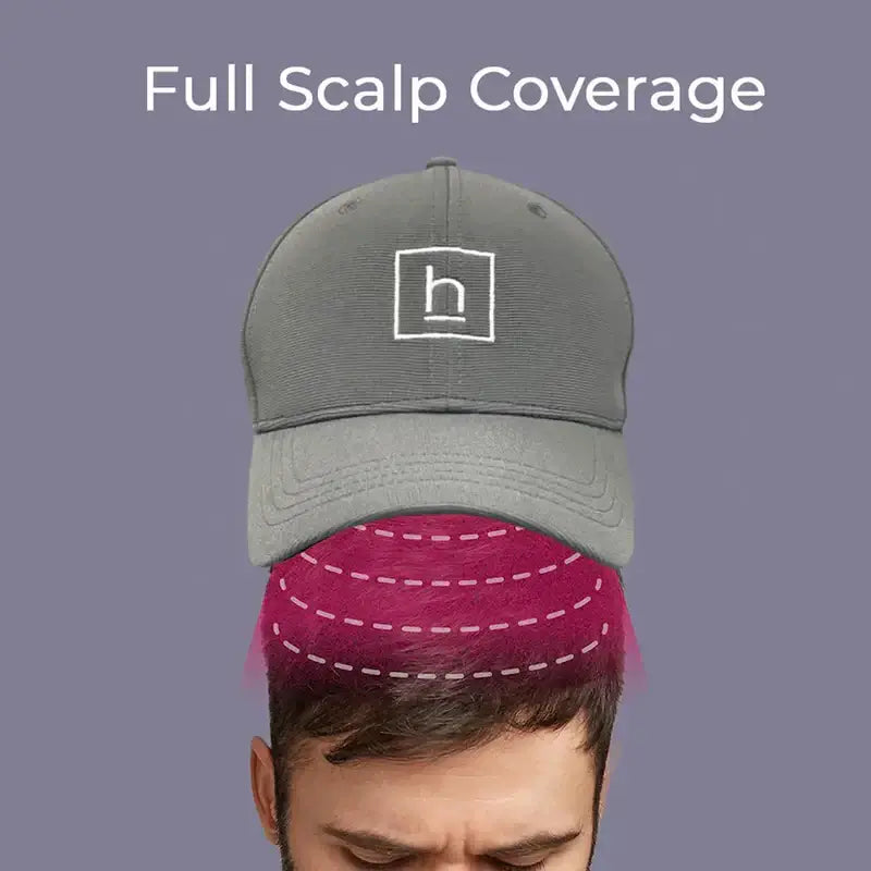 Hair growth laser cap demonstrating full scalp coverage for effective hair restoration.