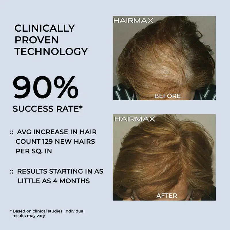LaserBand 82 hair growth device ComfortFlex Hair Growth
